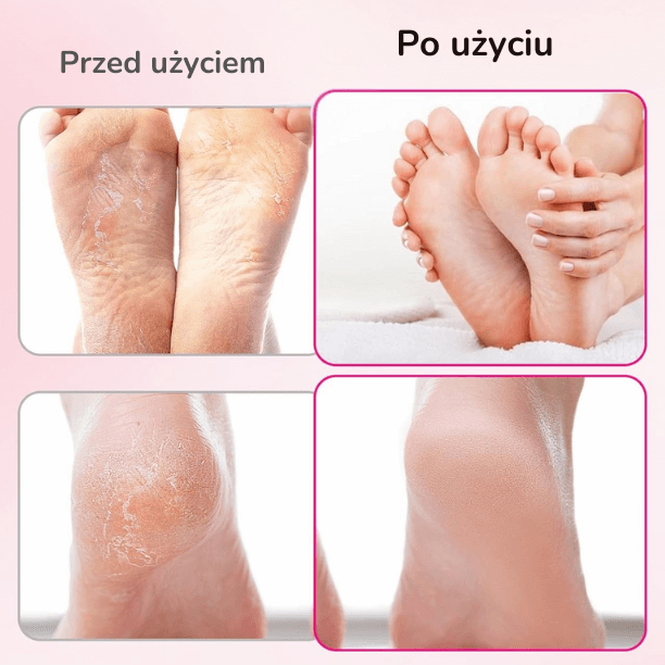SoftFoot - Elektryczny pilnik do stóp i paznokci + 30 krążków ściernych GRATIS